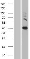 Human TGM2 / Transglutaminase 2 Protein (Over-Expression Lysate Myc-DDK (Flag))