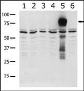 Polyclonal Rabbit anti-Human PAK7/PAK5 Antibody (aa168-198, IHC, WB)