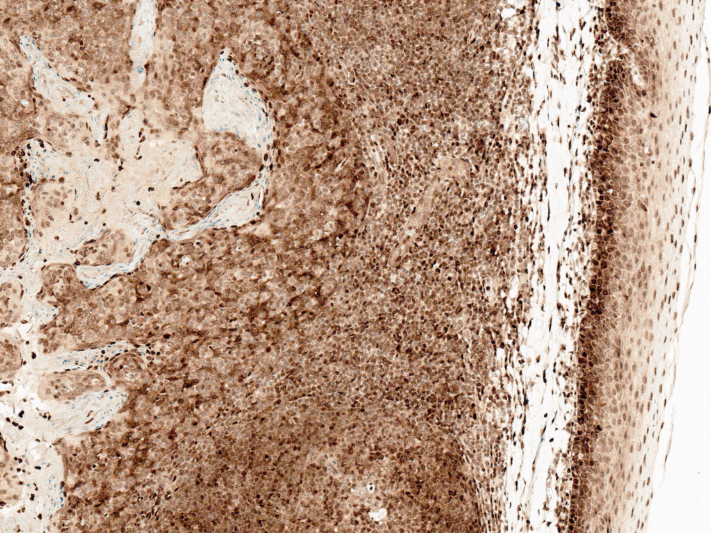 CCR2 Antibody (FITC)