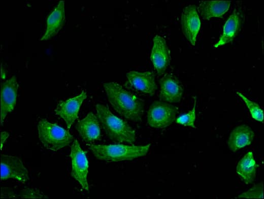 CAV2 / Caveolin 2 Antibody