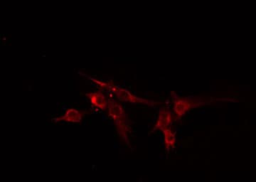 Polyclonal Rabbit anti-Human AMPH / Amphiphysin Antibody (IF, WB)
