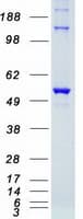 Human STK38 Protein (Recombinant Myc-DDK (Flag))