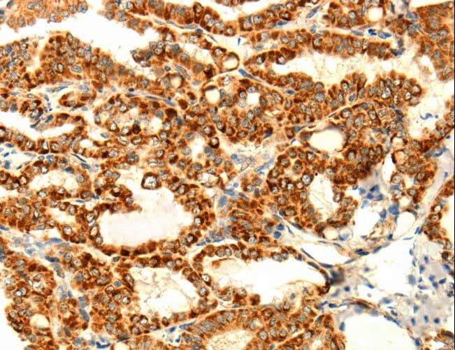 Polyclonal Rabbit anti-Human DIABLO / SMAC Antibody (IHC, WB)