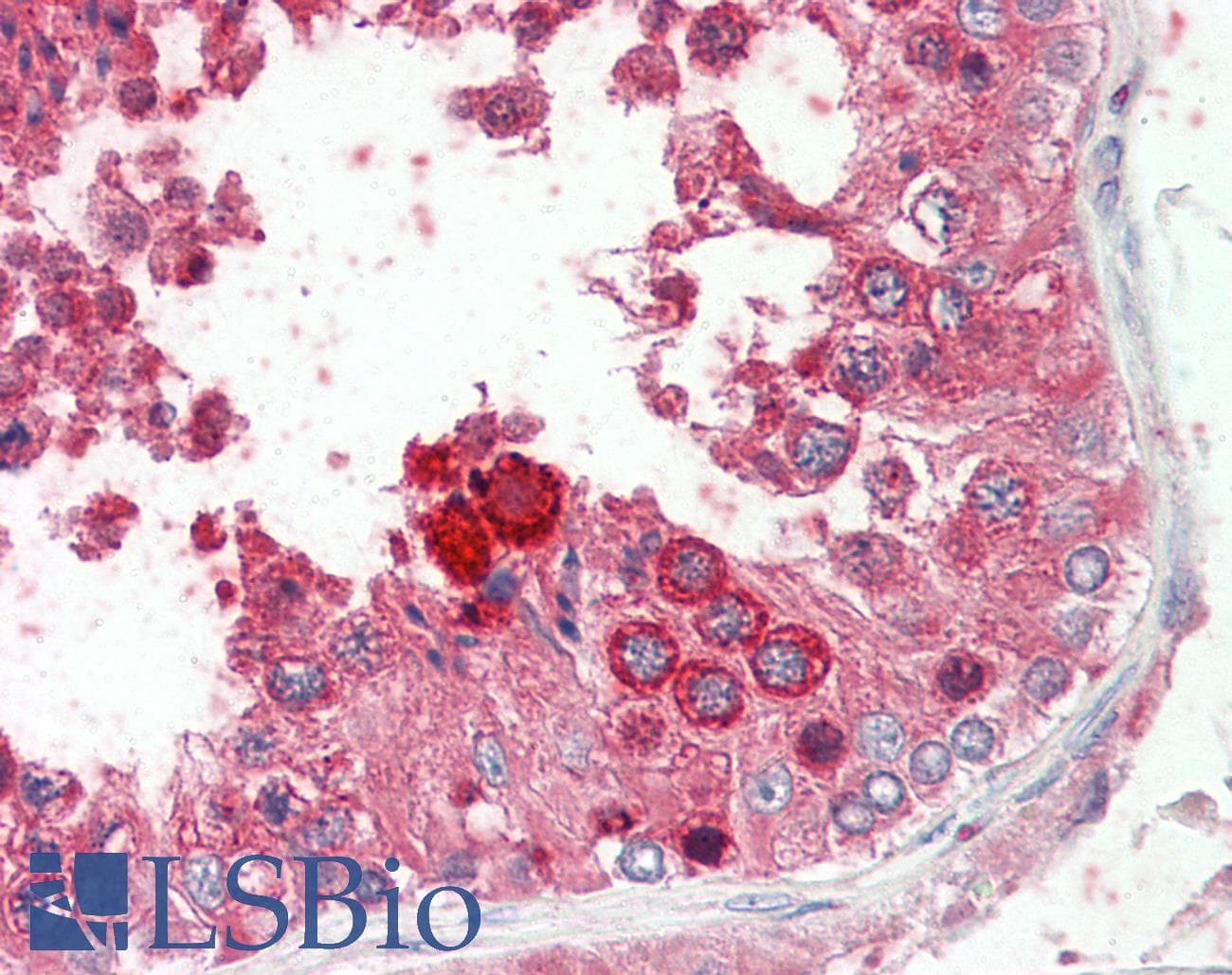 IHC-plus™ Polyclonal Goat anti-Human PK2 / PROK2 Antibody (aa69-83, IHC)