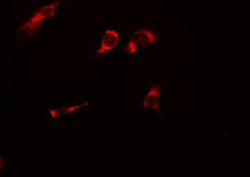 HSP90AB1 / HSP90 Alpha B1 Antibody