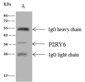 P2RY6 / P2Y6 Antibody (Preservative Free)