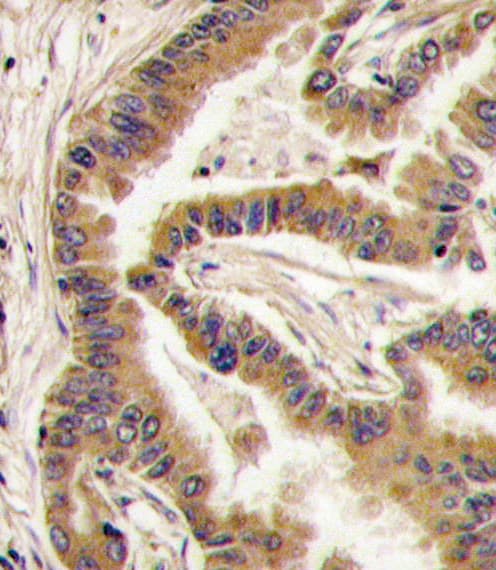 Polyclonal Rabbit anti-Human CSNK1A1 / CK1 Alpha Antibody (aa309-337, IHC, WB)