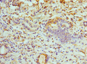 IHC-plus™ Polyclonal Rabbit anti-Human ATP6V1B1 Antibody (aa1-280, IHC, WB)