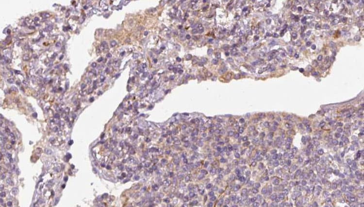 Polyclonal Rabbit anti-Human SLC38A3 / SNAT3 Antibody (IHC, IF, WB)