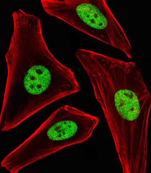 Monoclonal Mouse anti-Human SP1 Antibody (clone 1326CT463.109.176, IF, WB)