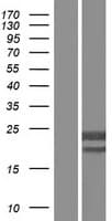 CMPK / CMPK1 Protein (Over-Expression Lysate Myc-DDK (Flag))
