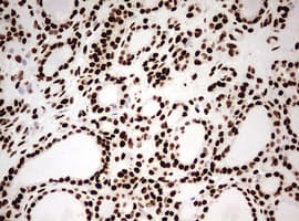 Monoclonal Mouse anti-Human HNRPM / HNRNPM Antibody (clone OTI3F3, aa1-261, IHC, WB)