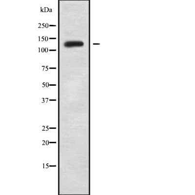 INPPL1 / SHIP2 Antibody