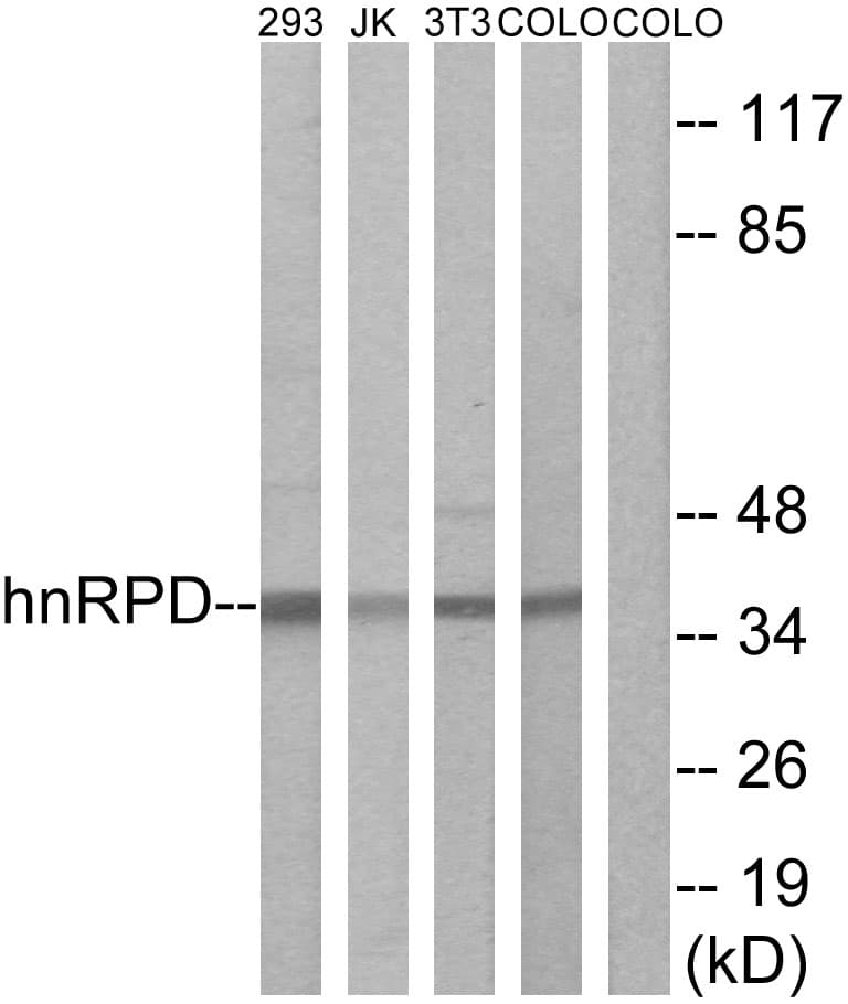 IHC-plus™ HNRNPD / AUF1 Antibody (aa49-98)