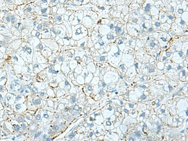 SHOOTIN1 / KIAA1598 Antibody