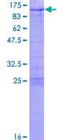 Human ZNF274 Protein (Recombinant GST)