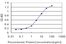 SLC6A4 / SERT Antibody (clone 2A9)