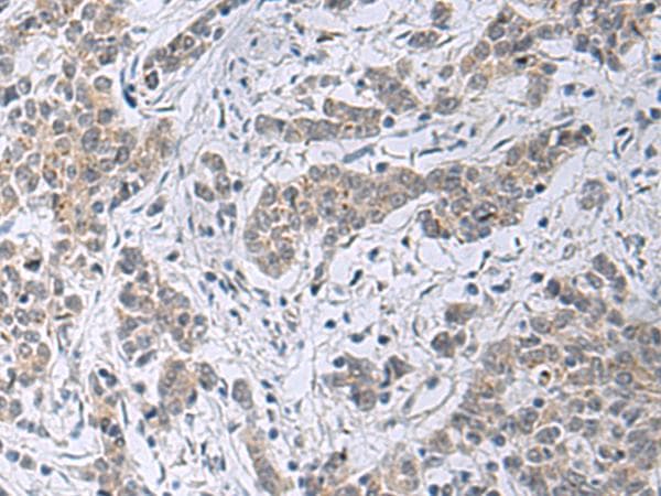 SLC4A3 / AE3 Antibody