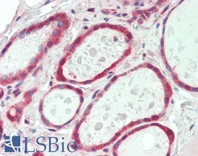 IHC-plus™ NETO2 Antibody (aa174-203)