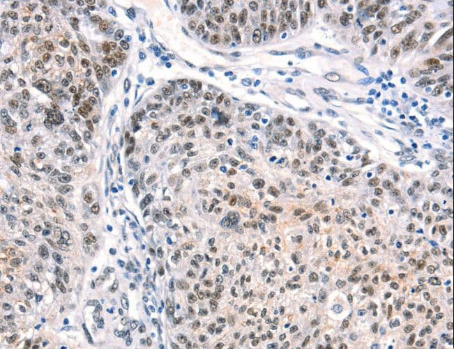 Polyclonal Rabbit anti-Human CTBP2 Antibody (IHC, WB)