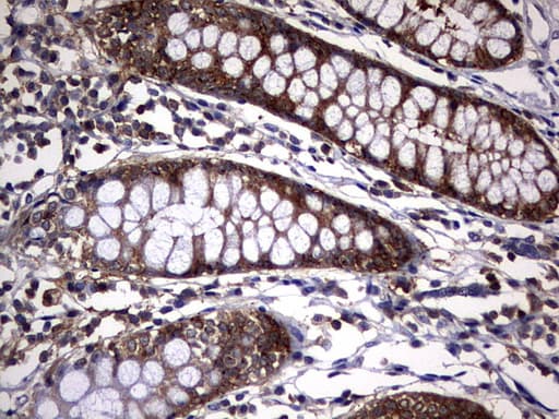 Monoclonal Mouse anti-Human KRT7 / CK7 / Cytokeratin 7 Antibody (clone OTI3B7, IHC, WB)