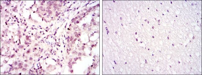 ATF2 Antibody (clone 4F12)