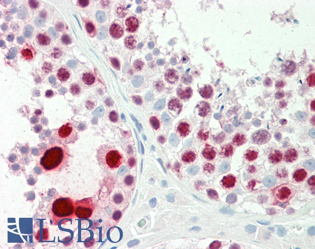 Polyclonal Rabbit anti-Human LFNG / Lunatic Fringe Antibody (aa74-123, IHC, WB)