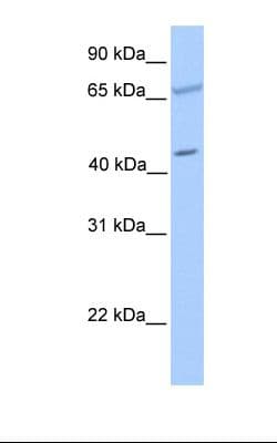 Polyclonal Rabbit anti-Human PDE1A Antibody (aa51-100, WB)