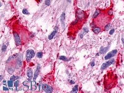 PathPlus™ GPR25 Antibody (N-Terminus)