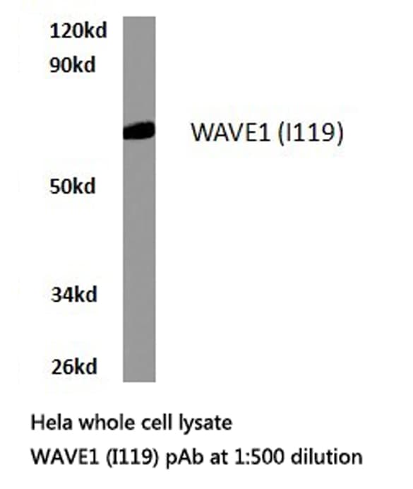 Polyclonal Rabbit anti-Human WASF1 / WAVE Antibody (Ile119, IHC, IF, WB)