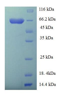 Human GDI2 Protein (Recombinant His-SUMO)