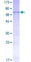 Human CYR61 Protein (Recombinant GST)