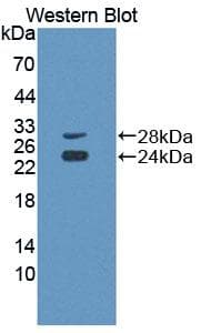 CD8A / CD8 Alpha Antibody (aa22-198, Biotin)
