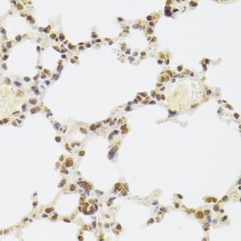 Polyclonal Rabbit anti-Human XRCC6 / Ku70 Antibody (IHC, IF, WB)