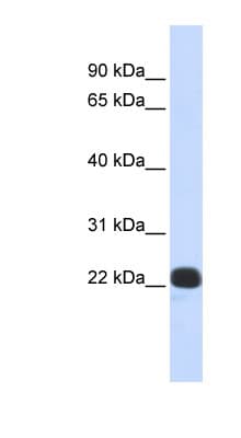 Recoverin Antibody (N-Terminus)