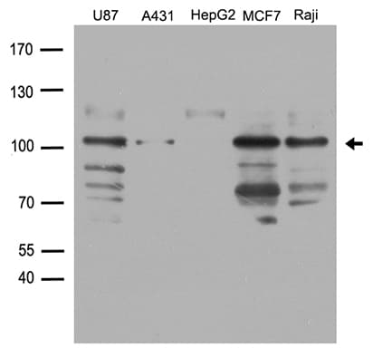 Polyclonal Rabbit anti-Human DDX58 / RIG-1 / RIG-I Antibody (WB)