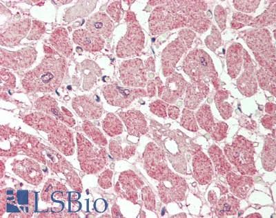 Polyclonal Rabbit anti-Human PLA2G5 Antibody (N-Terminus, IHC, WB)