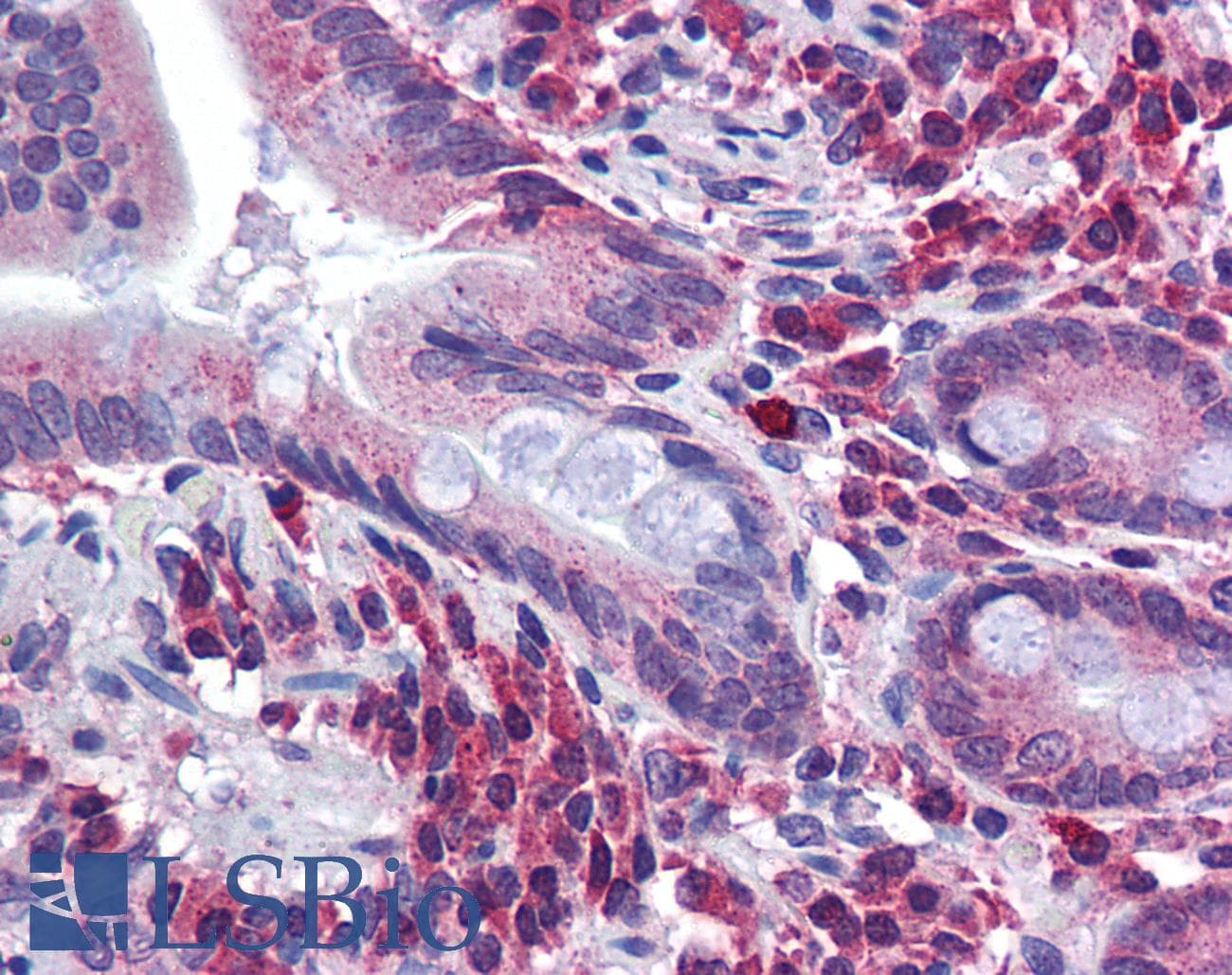 SPRY2 / Sprouty 2 Antibody (aa107-156)
