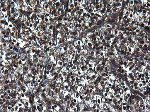 ZFAND3 / TEX27 Antibody (clone OTI1H9)
