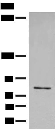 Polyclonal Rabbit anti-Human FGD3 Antibody (IHC, WB)
