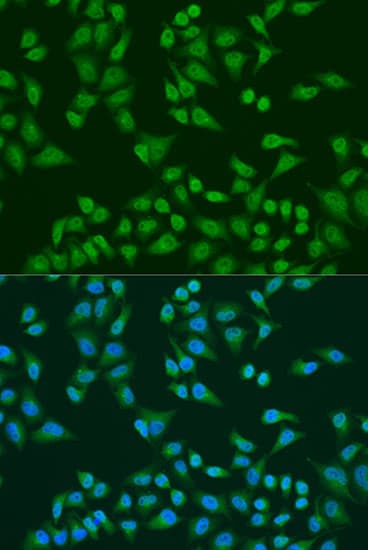 TIA-1 Antibody
