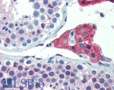 IHC-plus™ Monoclonal Mouse anti-Human GLO1 / Glyoxalase I Antibody (aa83-184, IHC, WB)