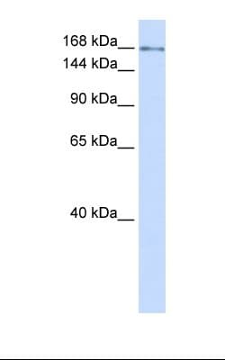 Polyclonal Rabbit anti-Human IFT172 Antibody (aa360-409, IHC, WB)
