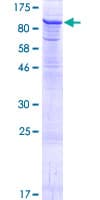 Human HIPK4 Protein (Recombinant GST)