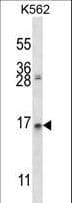 Polyclonal Rabbit anti-Human AGR2 Antibody (aa11-39, IHC, IF, WB)