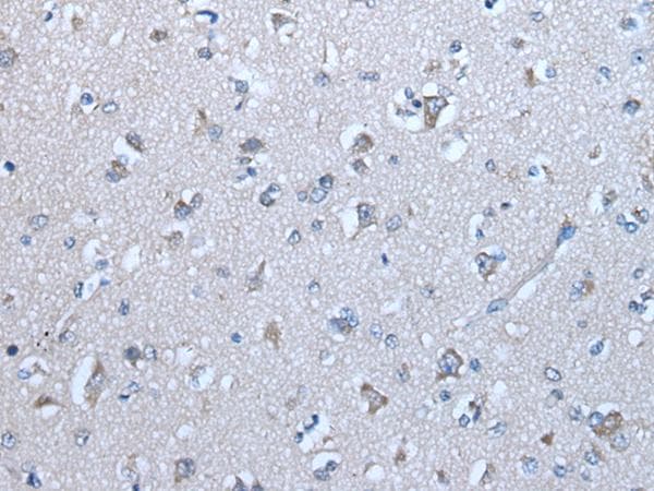 Polyclonal Rabbit anti-Human GJA1 / CX43 / Connexin 43 Antibody (IHC)