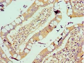 VTN / Vitronectin Antibody (aa364-478)