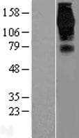 EPS15 Protein (Over-Expression Lysate Myc-DDK (Flag))