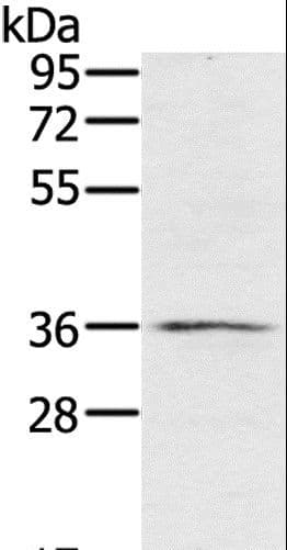 Polyclonal Rabbit anti-Human RNF144B Antibody (IHC, WB)