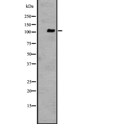 ADGRF1 / GPR110 Antibody